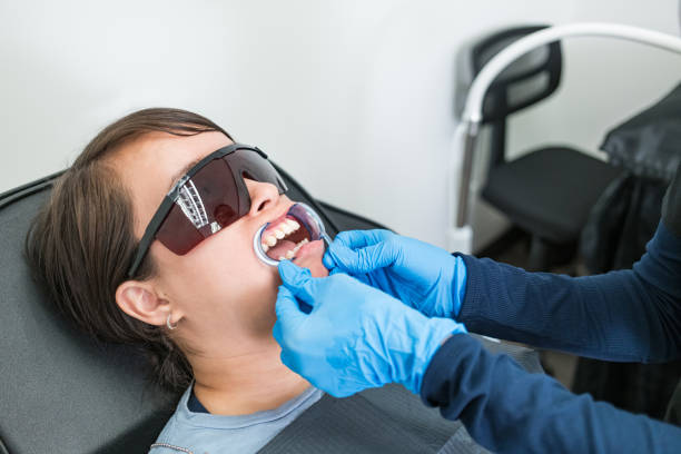 Best Knocked-Out Tooth (Avulsed Tooth) Treatment in Scotchtown, NY